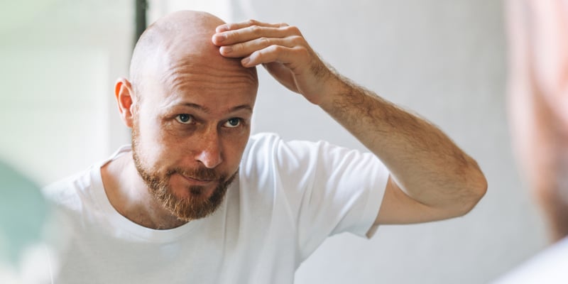 A man touching his bald head and looking at the mirror