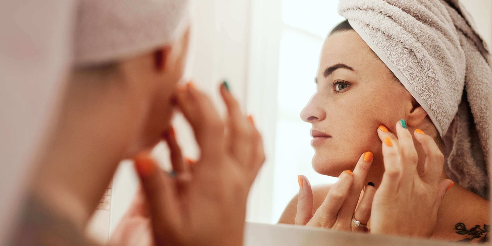 Understanding and treating adult acne